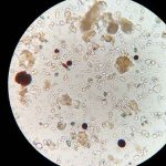 Microbios da canabis