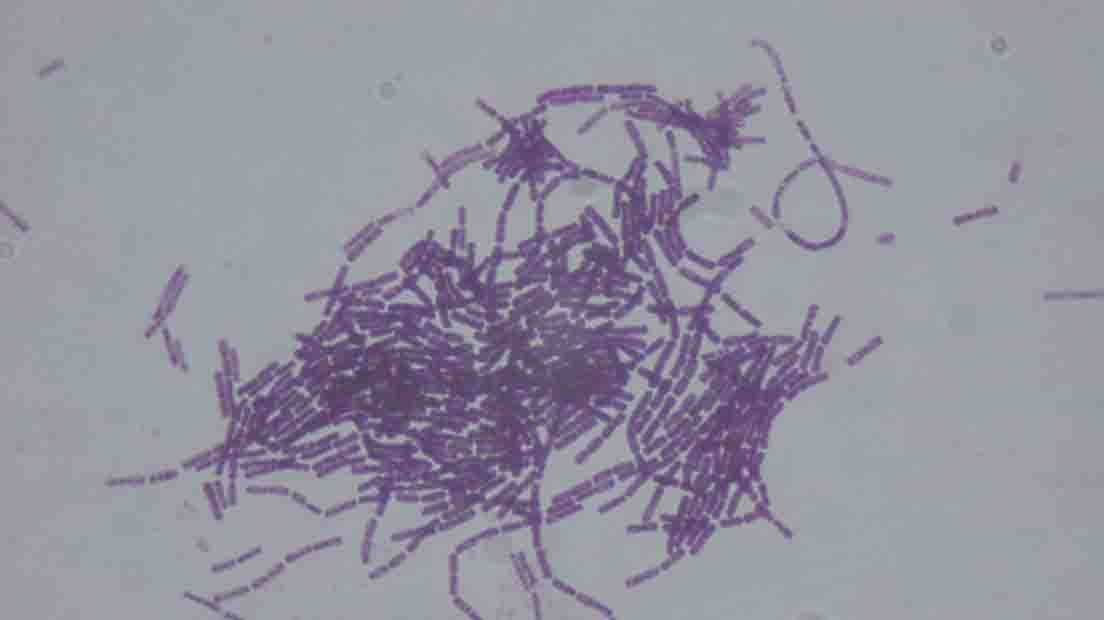El Bacillus Thuringiensis es un insecticida natural.
